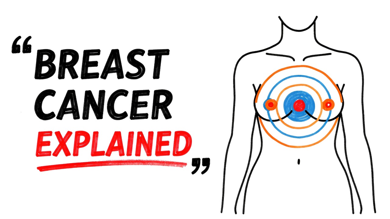 What Does "Stage 2 Breast Cancer" Actually Mean?